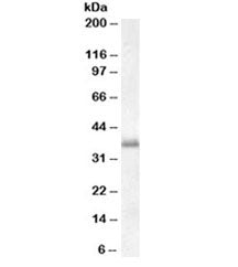 Western blot testing of peripheral blood mononucleocyte lysate with LAT1 antibody at 0.01ug/ml. Pred