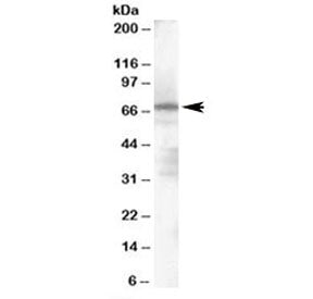 Western blot testing of human spleen lysate with PARP2 antibody at 1ug/ml. Predicted molecular weigh