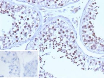 IHC staining of FFPE human testis tissue with recombinant BRCA1 antibody (clone BRCA1/13502R). Inset