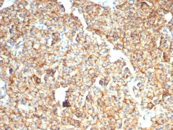 IHC staining of FFPE dog liver with EpCAM / CD326 antibody (clone rEGP40/7334). HIER: boil tissue se