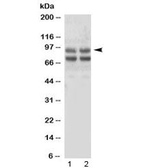 Western blot testing of human 1) SMMC-7721 and 2) HepG2 cell lysate with Angiostatin K1-3 antibody. 