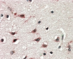 IHC staining of FFPE human cerebral cortex with DYX1C1 antibody at 5ug/ml. HIER: steamed with pH6 ci