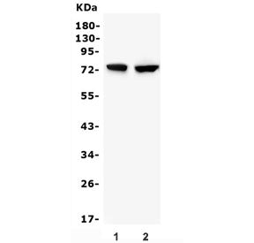 Western blot testing of 1) rat liver and 2) mouse liver lysate with Gusb antibody. Expected molecula