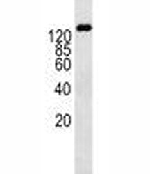 P-Glycoprotein antibody western blot analysis in K562 lysate. Expected molecular weight: 141-180 kDa