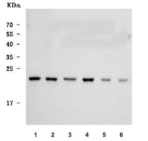 Western blot testing of 1) human Caco-2, 2) human RT4, 3) human HepG2, 4) human Daudi, 5) rat testis
