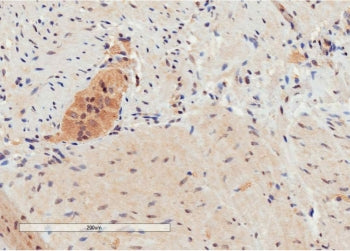 IHC testing of FFPE human colon tissue with GPR120 antibody at 2ug/ml. Specific staining of lymphoid