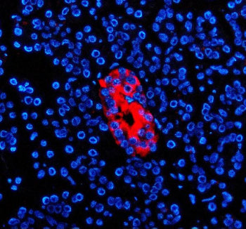 Immunofluorescent staining of ZNT8/SLC30A using anti-SLC30A antibody (red). ZNT8/SLC30A was detected
