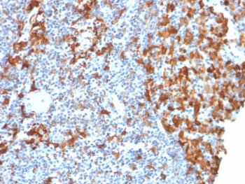 IHC testing of FFPE human lymph node with recombinant IBA1 antibody (clone rAIF1/1909). HIER: boil t