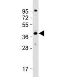Western blot testing of human HeLa cell lysate with DNAJB4 antibody at 1:2000. Predicted molecular w