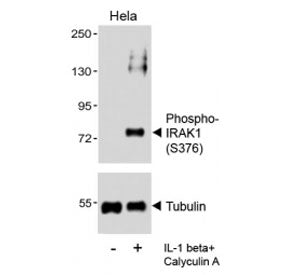 Western blot analysis of lysates from the human HeLa cell line, untreated or treated with IL-1 beta 