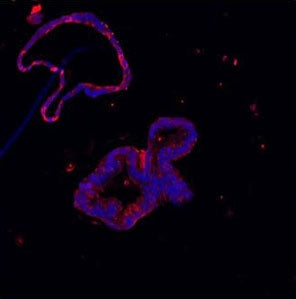 Lysozyme Antibody / LYZ