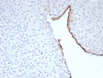 IHC staining of FFPE human bladder tissue with Uroplakin 3B antibody (clone UPK3B/8768R). HIER: boil