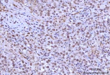 RNF40 Antibody / BRE1B