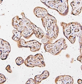 IHC staining of FFPE human placental tissue with CARS antibody. HIER: boil tissue sections in pH8 ED