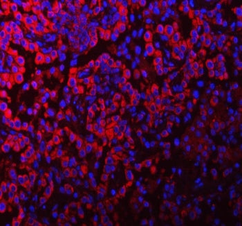 PACSIN2 Antibody