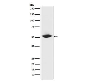 Western blot testing of human recombinant protein with MMP1 antibody. Predicted molecular weight ~54