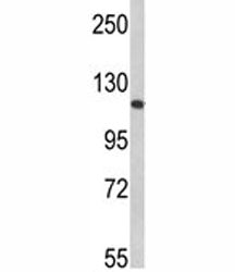 Rb Antibody (Retinoblastoma)