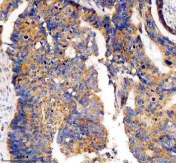PDE4A Antibody / cAMP-specific 3,5-cyclic phosphodiesterase 4A, 100ug