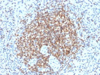 IHC testing of FFPE human spleen tissue with recombinant Bcl-2 antibody (clone BCL2/2210R). HIER: bo