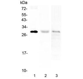 Western blot testing of human 1) A375, 2) HL60 and 3) CCRM-CEM cell lysate with PTCRA antibody at 0.