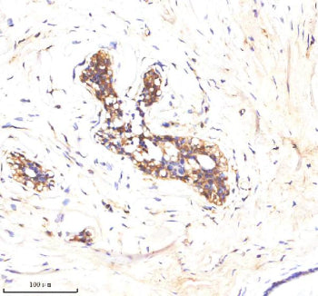 Immunohistochemical staining of ATP1A2 using anti-ATP1A2 antibody. ATP1A2 was detected in a paraffin