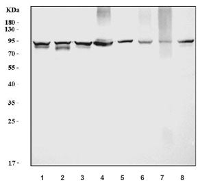 Prothrombin Antibody
