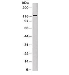 P-Cadherin Antibody / CDH3