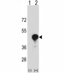 Western blot analysis of CD1c antibody and 293 cell lysate (2 ug/lane) either nontransfected (Lane 1