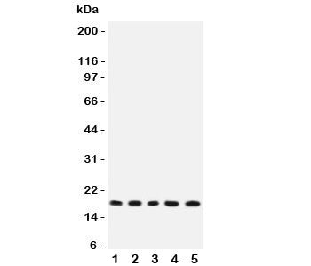 Western blot testing of IL-2 antibody and rat samples 1: thymus; 2: liver; 3: NRK; 4: PC12; 5: RH35 