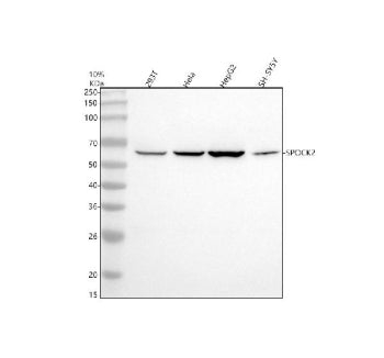 Western blot analysis of SPOCK2 using anti-SPOCK2 antibody. Electrophoresis was performed on a 10% S