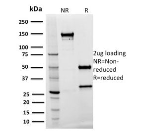 SDS-PAGE analysis of purified, BSA-free Spastin antibody (clone Sp 3G11-1) as confirmation of integr