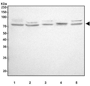 Western blot testing of 1) human A549, 2) human MCF7, 3) human Jurkat, 4) rat RH35 and 5) mouse RAW2