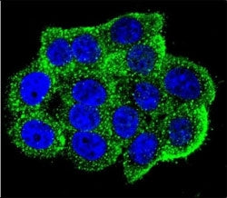Confocal immunofluorescent analysis of Hamartin antibody with HeLa cells followed by Alexa Fluor 488