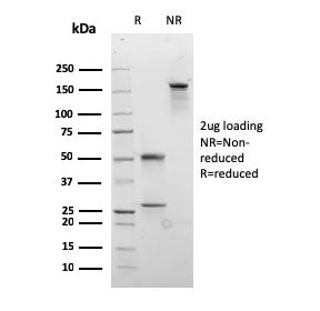 SDS-PAGE analysis of purified, BSA-free recombinant Desmocollin 2/3 antibody (clone rDSC2/3437) as c