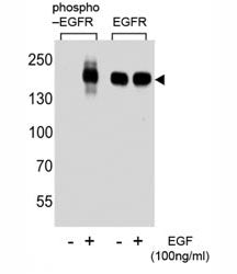 EGFR Antibody (phospho-S1070)