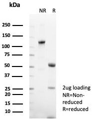CD48 Antibody (Pan Leukocyte Marker)