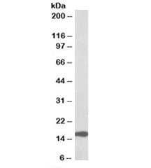 Western blot testing of human colorectal cancer lysate with RPL23 antibody at 0.1ug/ml. Predicted mo