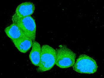 S100A4 Antibody / FSP1