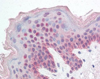 IHC testing of FFPE human skin tissue with KDM2B antibody at 5ug/ml. HIER: steamed antigen retrieval