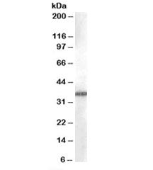 Western blot testing of A549 cell lysate with AKR1B10 antibody at 0.03ug/ml. Predicted molecular wei