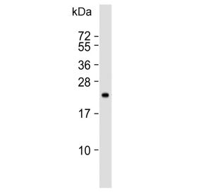 Western blot testing of human SW480 cell lysate with TIMP2 antibody. Predicted molecular weight ~24 