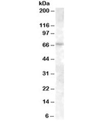 Western blot testing of A431 lysate with ABCE1 antibody at 0.3ug/ml. Predicted molecular weight: ~68