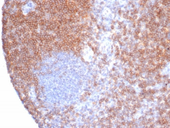 IHC staining of FFPE human tonsil tissue with CD6 antibody (clone rC6/372). HIER: boil tissue sectio