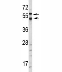 Western blot analysis of CA9 antibody and HepG2 lysate. Predicted molecular weight: 58 kDa and 54 kD