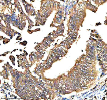 Immunohistochemical staining of QRSL1 using anti-QRSL1 antibody. QRSL1 was detected in a paraffin-em