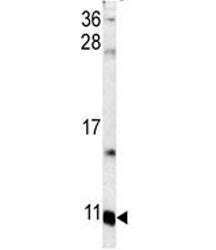 Western blot analysis of S100A6 antibody and mouse lung tissue lysate. Expected/observed molecular w