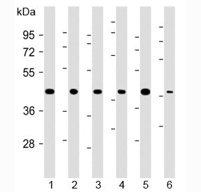 TBP Antibody (TATA Binding Protein)