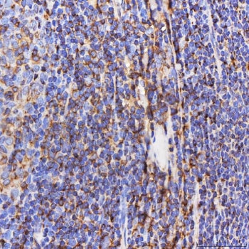 SEPT6 Antibody / Septin 6