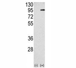 Amyloid beta Precusor Protein Antibody (APP)