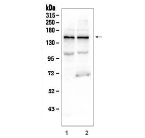 Western blot testing of human 1) K562 and 2) U-2 OS cell lysate with KCNH2 antibody. Expected molecu